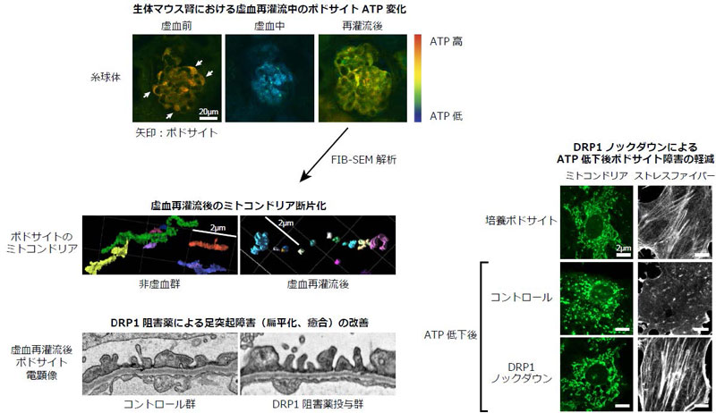 ATP動態から見る虚血後糸球体障害の病態解明～ミトコンドリア分裂抑制によるポドサイト保護～