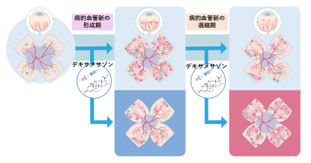 ステロイドが新生血管病変に与える二面性～病的血管新生を抑制するが、修復的な血管再構築を損なう～