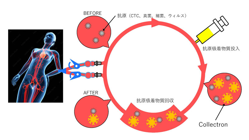 文章を入れてください