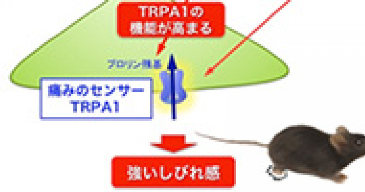 しびれ による痛みのメカニズムを解明 糖尿病や血流障害によるしびれ治療薬の開発に期待 京都大学