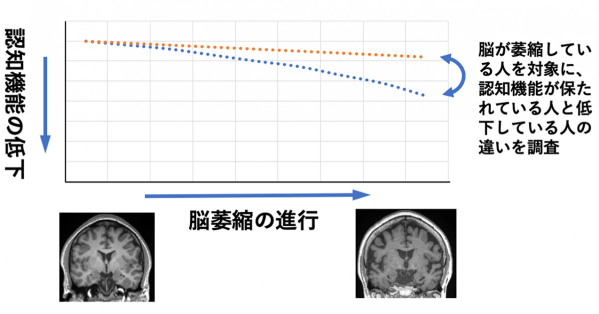 脳が萎縮しても認知機能が保たれる人は? －1799人の脳ドックと脳の健康 