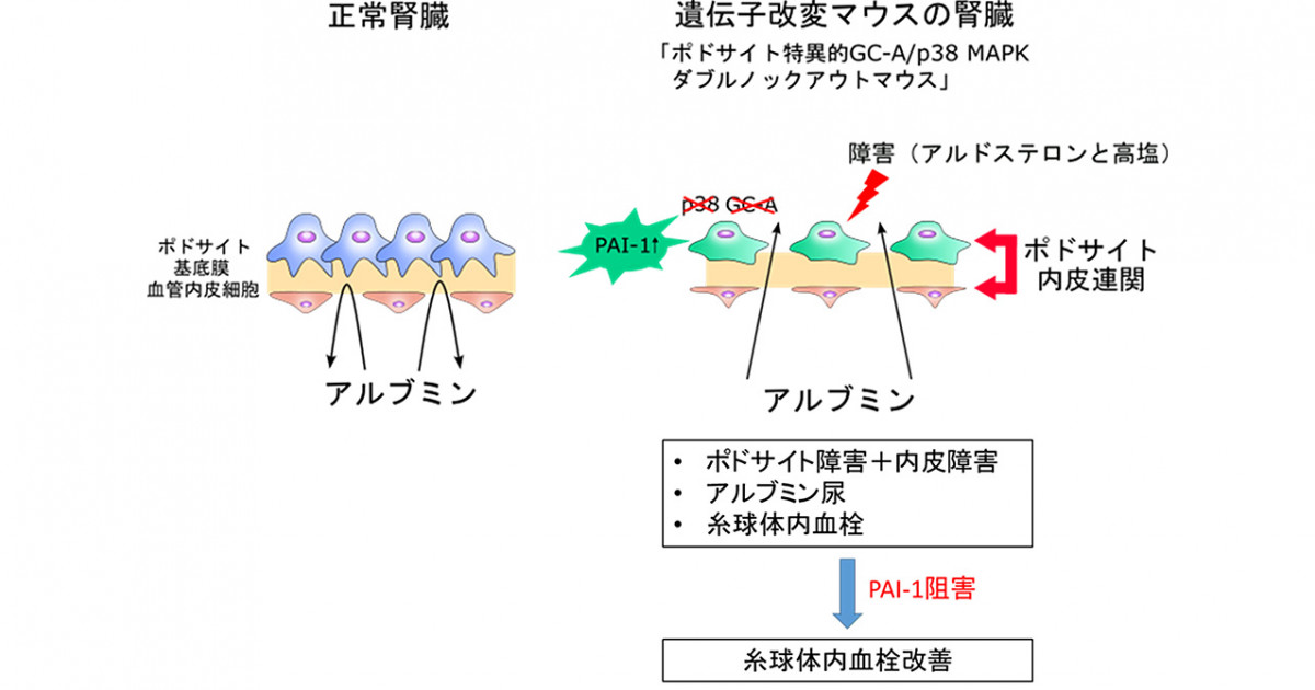 ポドサイトにおけるGC-Aとp38 MAPKの欠損はアルドステロンによる腎障害 