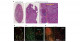 Improving the Safety of iPS Cell-Derived Pancreatic Islets by Eliminating Unwanted Cells